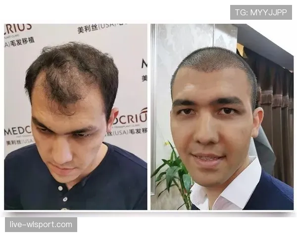 欧文又换发型了,这回训练迟到是因为编脏辫? 欧文又换发型了,这回训练迟到是因为编脏辫?